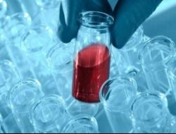 Kemik �li�i Bekleyenlere Umut