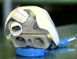 D�nyan�n �lk Yapay Kalbi Nakledildi